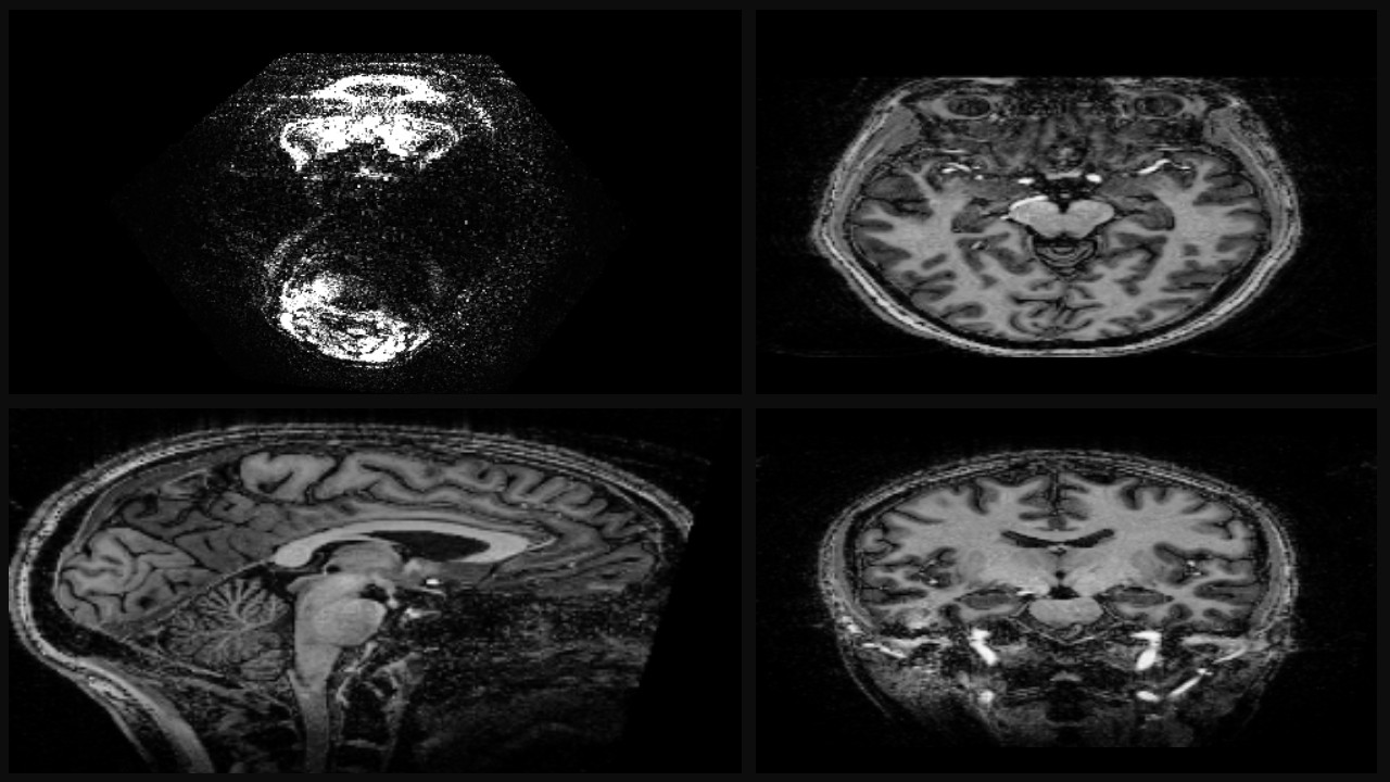 3D Brain MRI Viewer