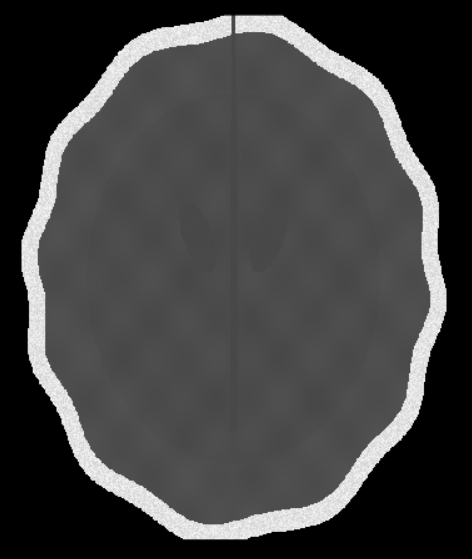 DICOM Viewer - Vanilla JS Medical Imaging