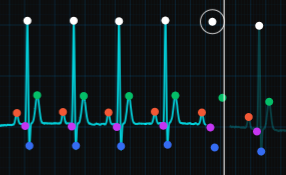 ECG Waveform Feature Extractor - Interactive Laboratory