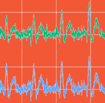 ECG Simulator