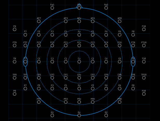 EEG Electrode Positions (10-20 vs. 10-10 System) - Interactive Laboratory