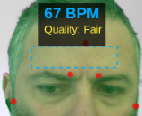 Real-Time Signal Amplification Microscope