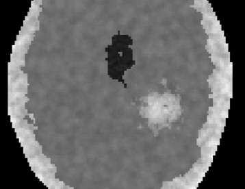 MRI Synthetic Brain Generator