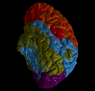 MicBrain Audio-Driven Brain Activation Visualization