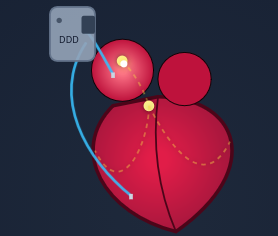 Cardiovascular Pacemaker Simulation
