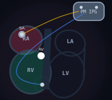 Pacemaker Cardiac Conduction Simulator - Dual-Chamber Model