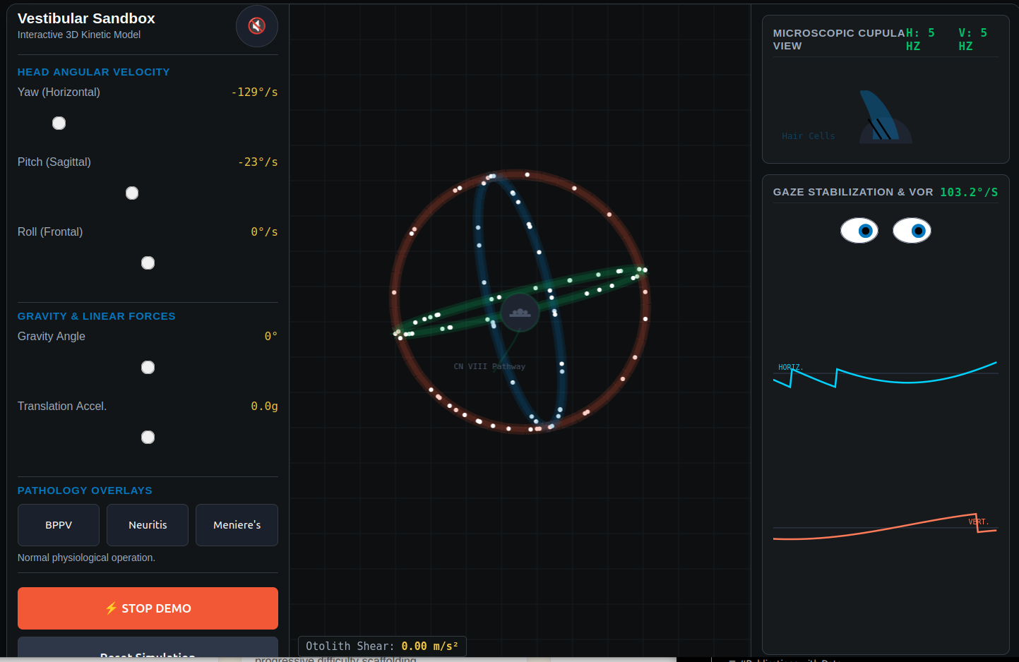 Vestibular System: Function & Anatomy Simulation
