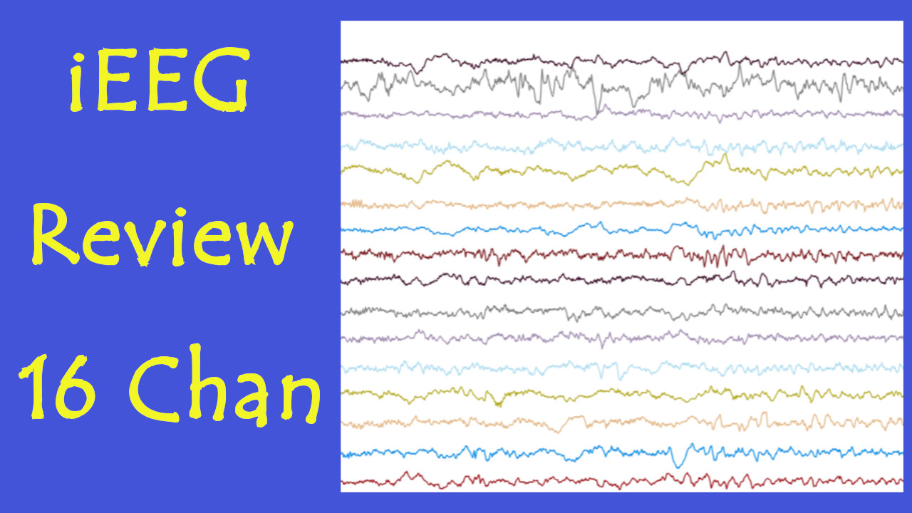 iEEG Multi-Channel Stack Visualization - Interactive Clinical Analysis Lab