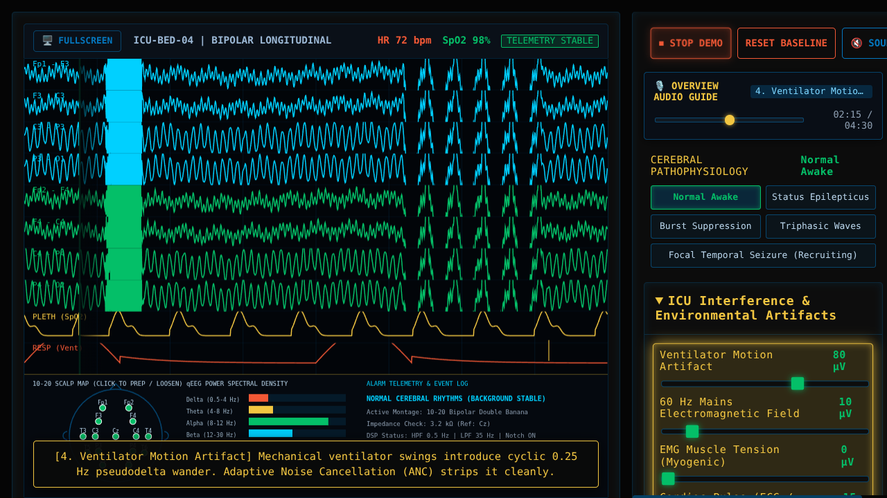 EEG Monitoring in ICU - Interactive Laboratory & DSP Simulator