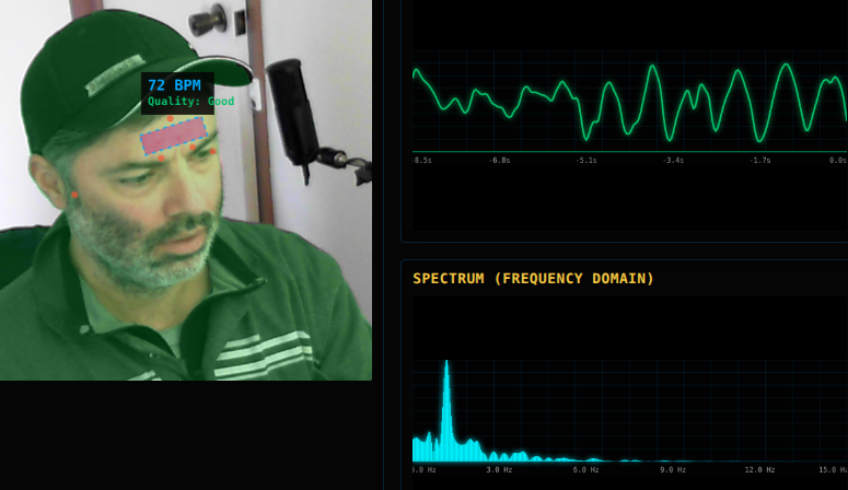 Real-Time Signal Amplification Microscope