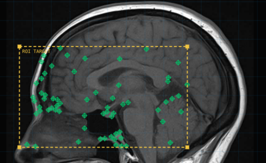 Feature Extraction from Images - Interactive Laboratory