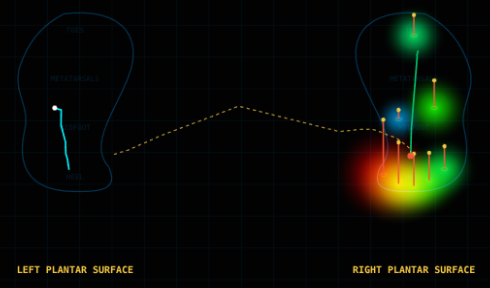 Gait Analysis Application - Biomechanical Foot Pressure Laboratory