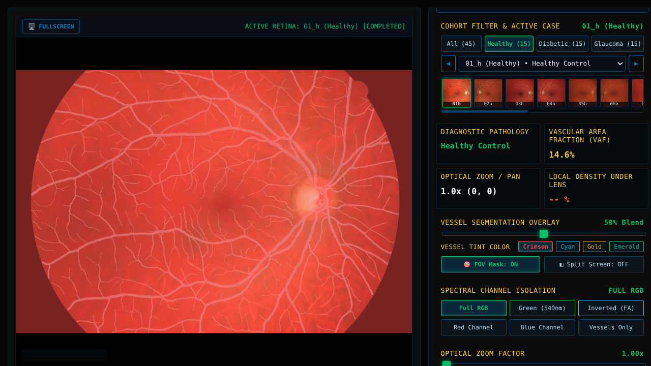 HRF Retinal Vasculature & Diagnostic Fundus Workstation - Interactive Laboratory