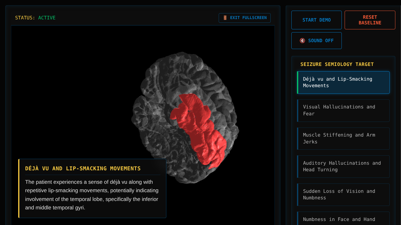 SeizureZone: Interactive 3D Brain Mapping Visualizer