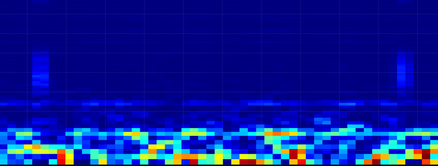 iEEG Spectrogram Visualization - Interactive Epileptic Seizure Analysis Lab