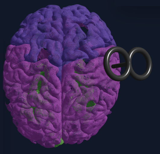 Interactive TMS Simulation